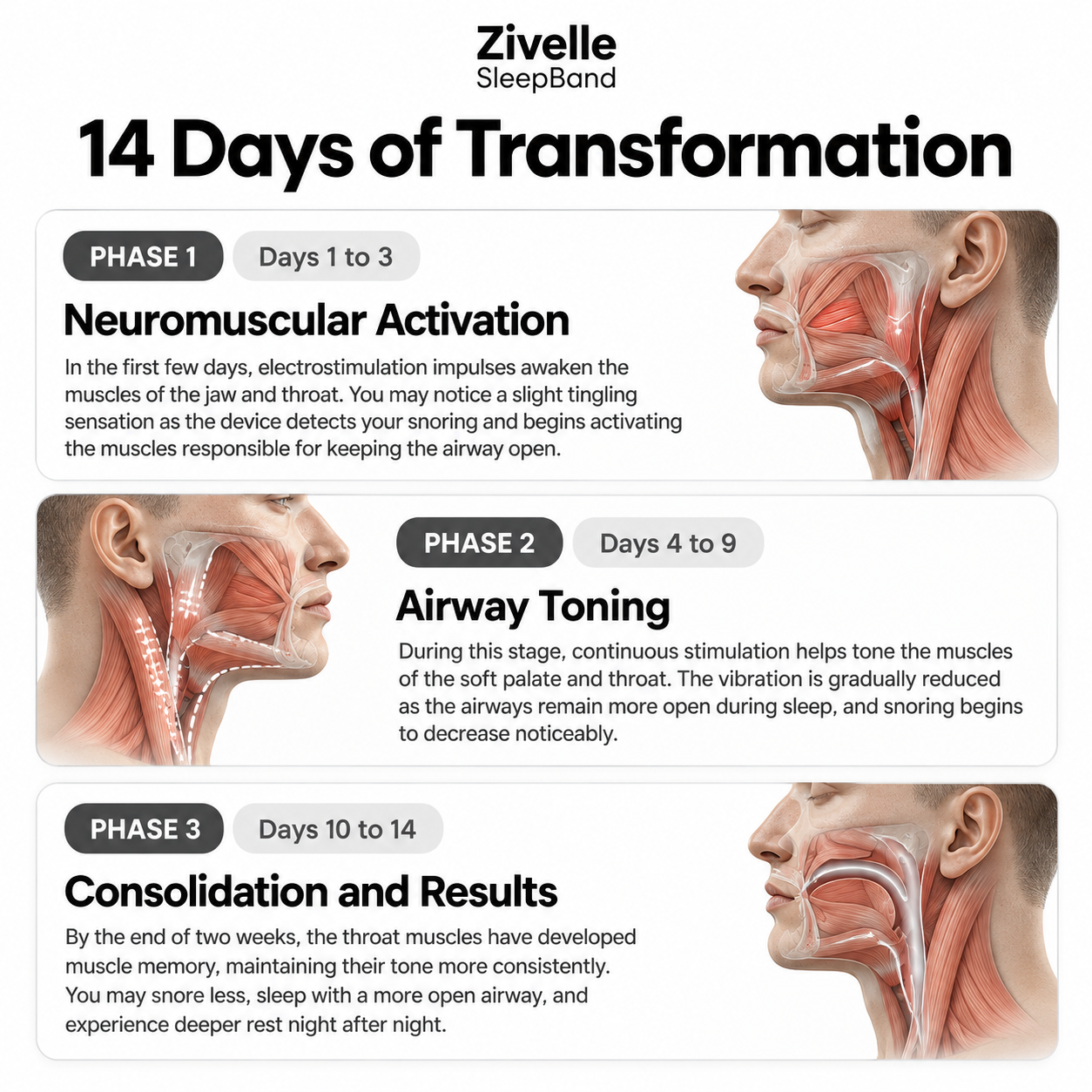 Zivelle™ SleepBand
